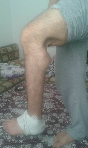 A refugee in need of a surgery