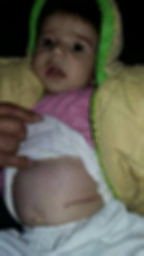 An infant needs help