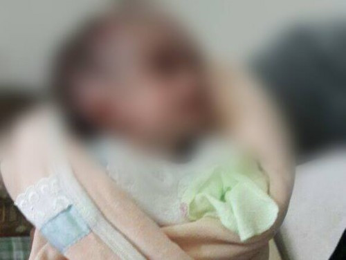 Child needing surgery