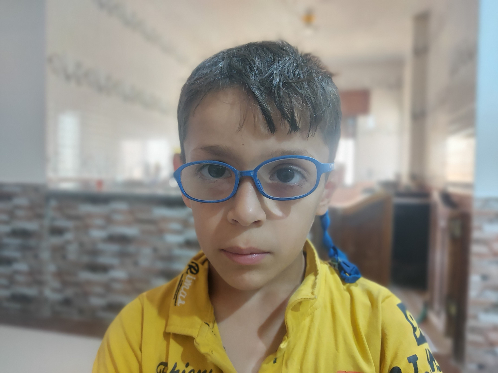Majd suffers from esotropia and needs immediate correct surgery!
