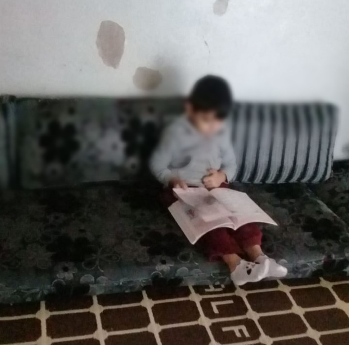 A little child suffers from hydronephrosis