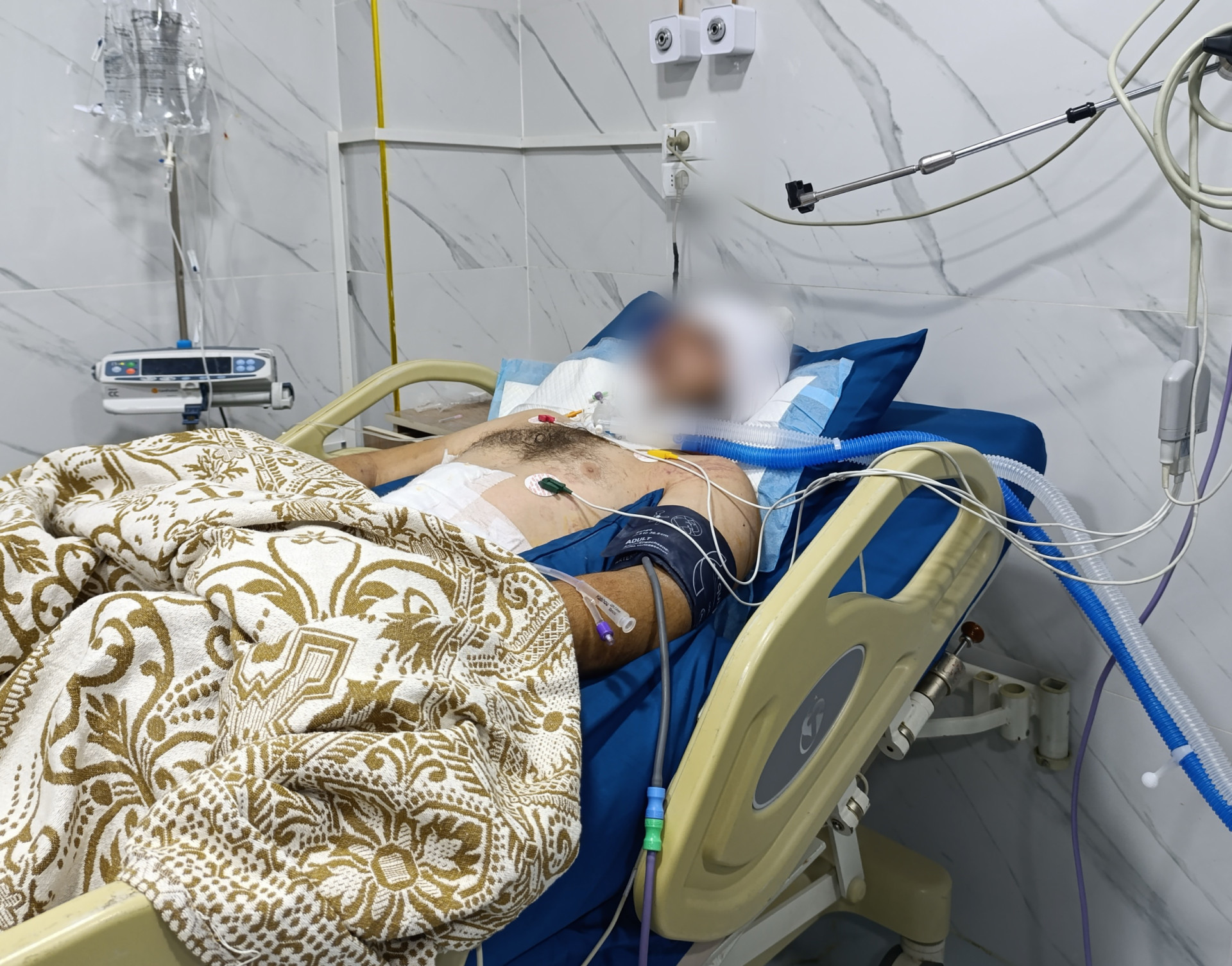 Mohammad is in a critical health condition!