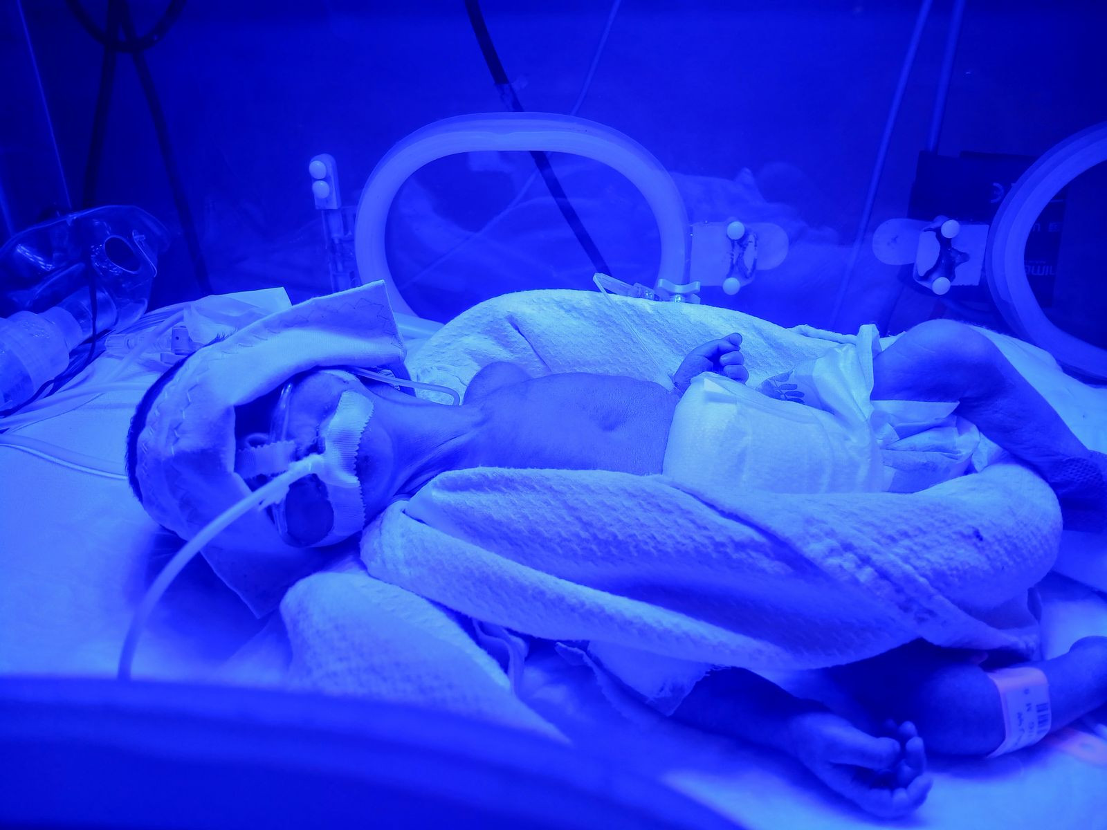 Rehab is in the incubator, and her life is at risk