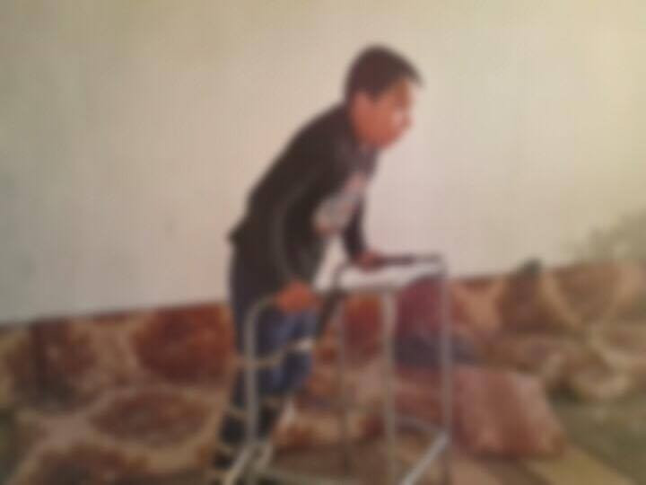 A child suffers from hemiplagia