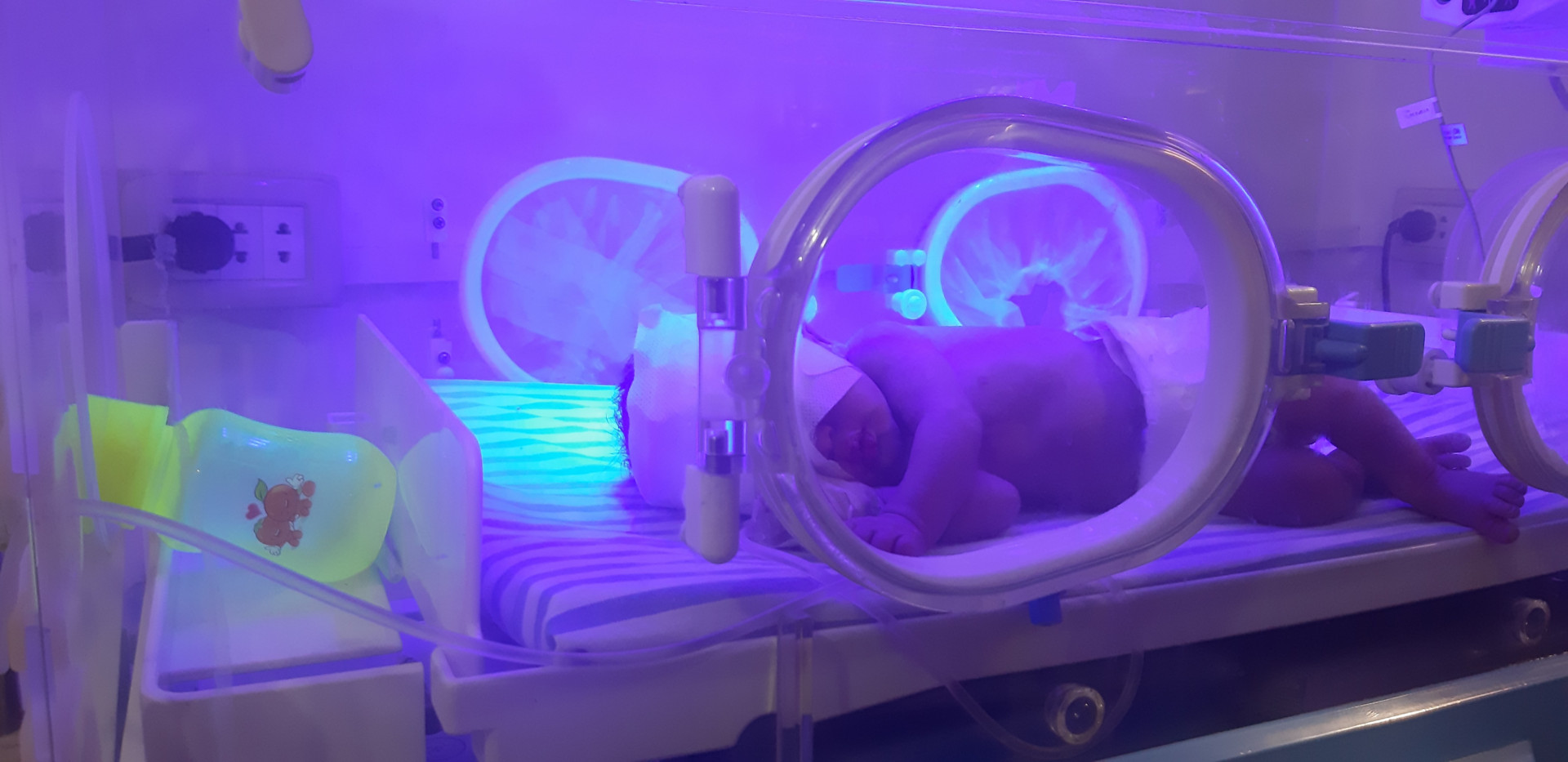 a baby girl needs our help