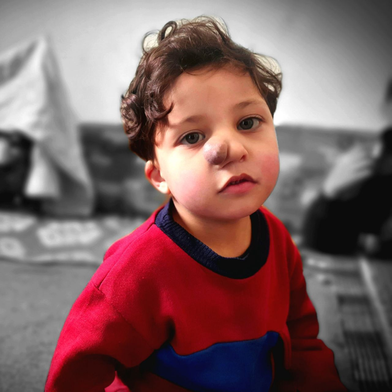 Imad is a child who needs urgent surgery! He needs your help!