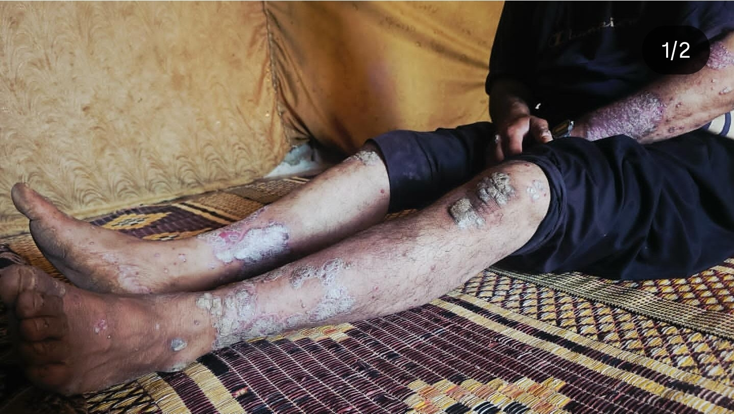 Urgent Humanitarian Cases !