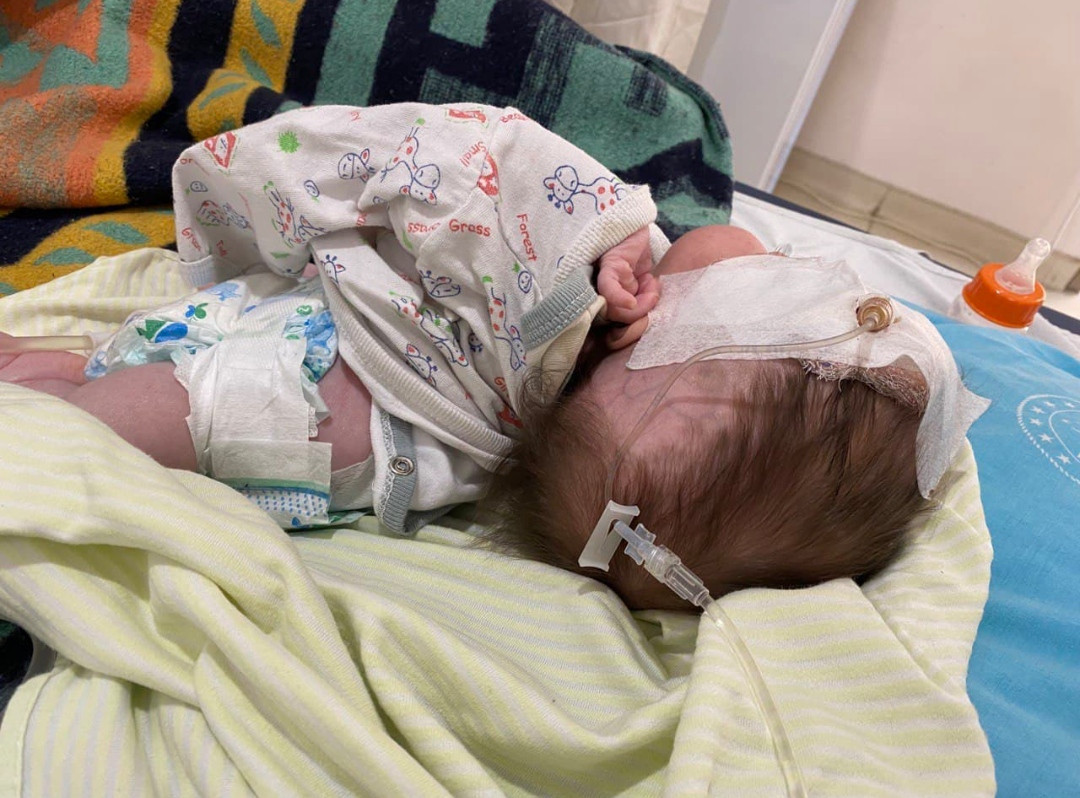 Nisreen has hydrocephalus and needs urgent surgery