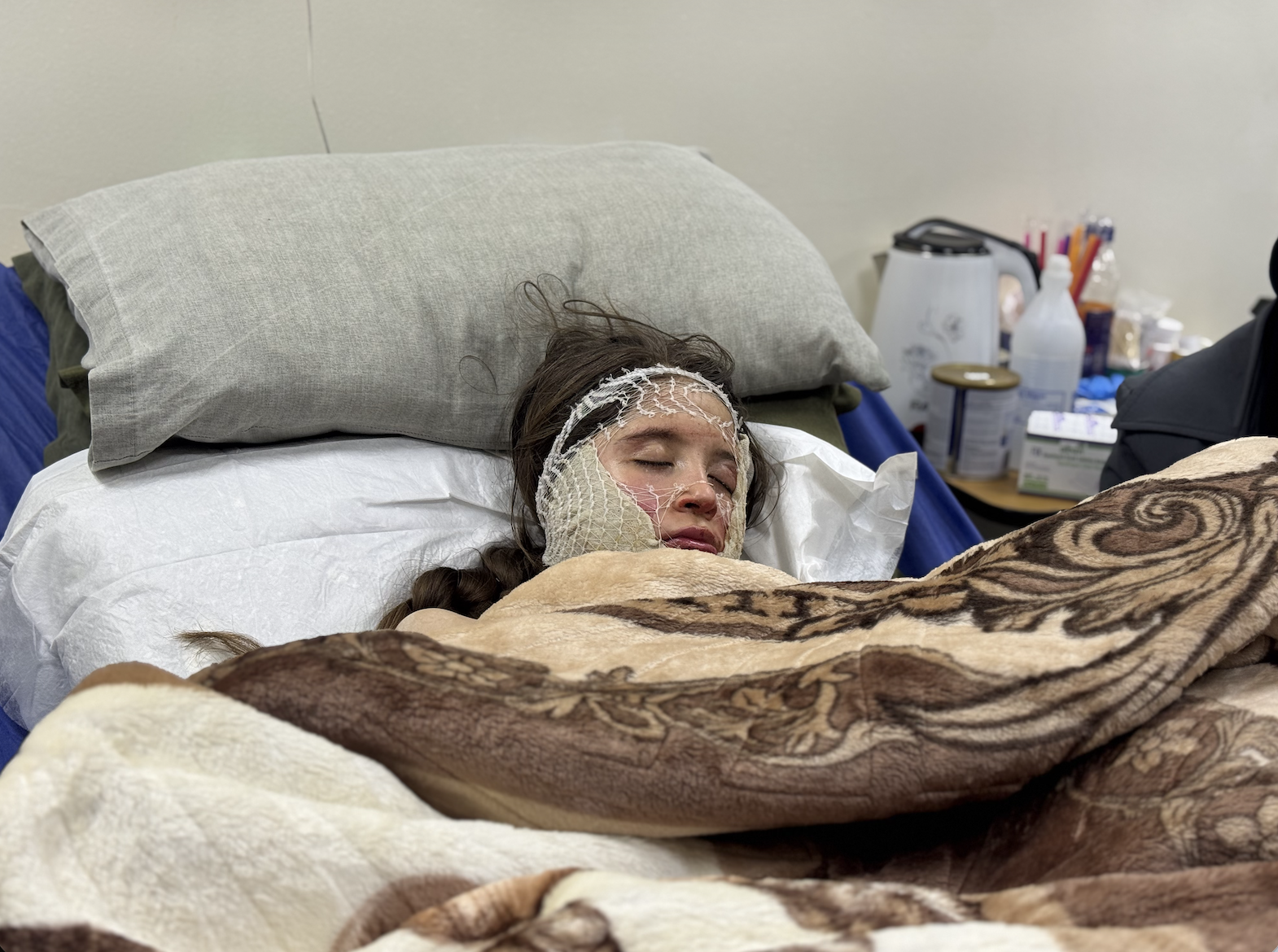 Burns Covering Little Rama’s Face