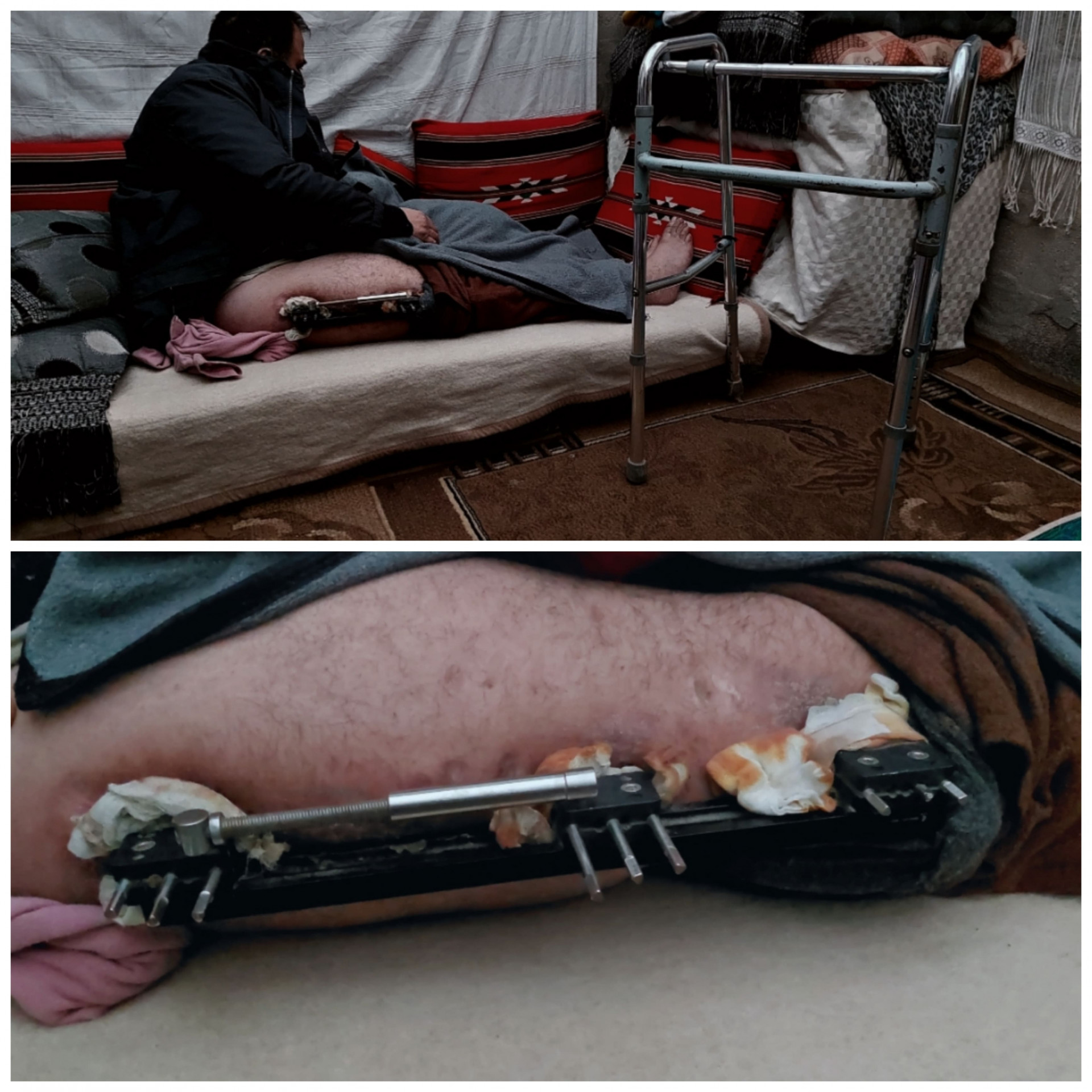 Hanadi's Family lives in a small tent and in dire need for your support