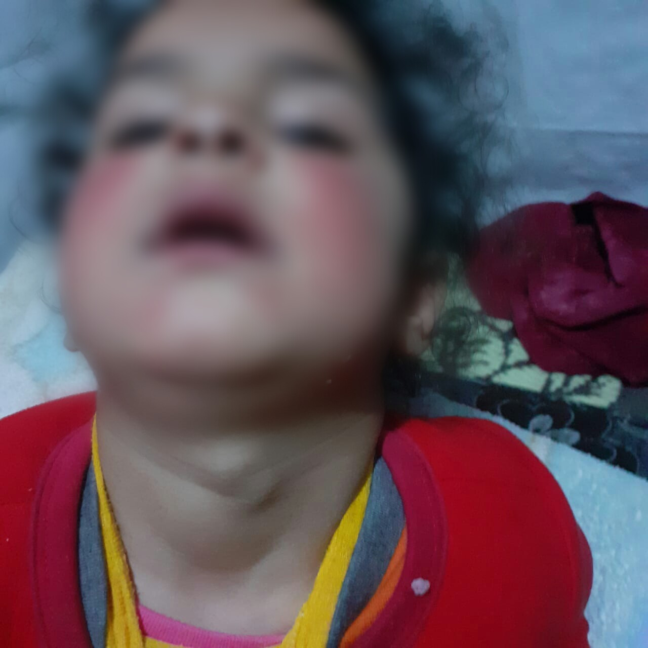 طفلة يتيمة بحاجة لعمل جراحي!