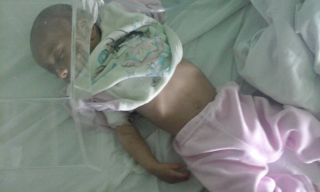Open heart surgery for an infant