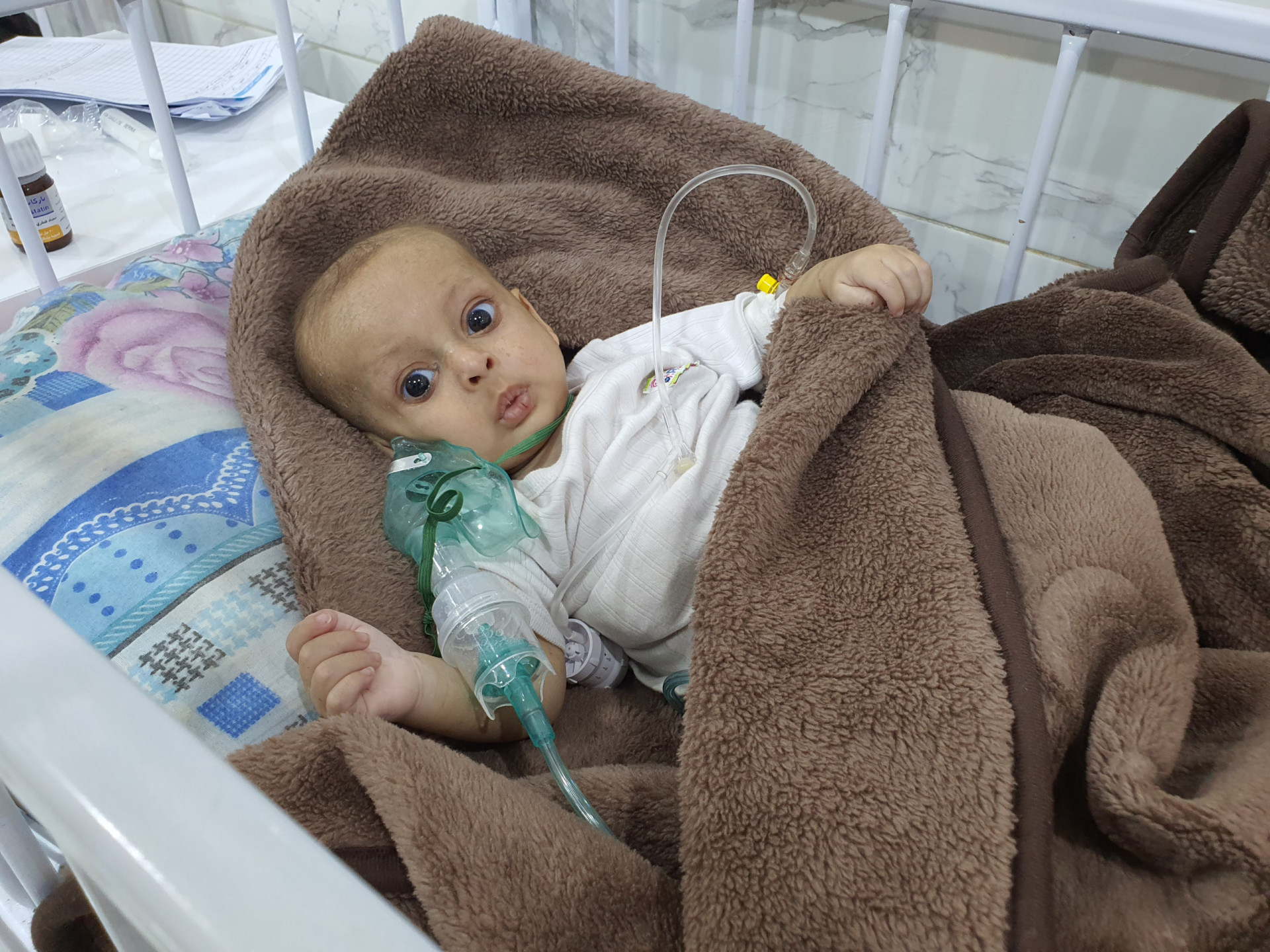 Respiratory infection, pneumonia, bronchitis and hepatosplenomegaly . The 1-year-old suffers from all these diseases!