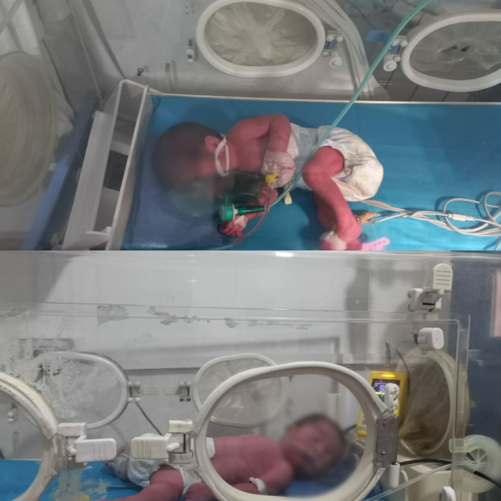 Twins need an incubator!