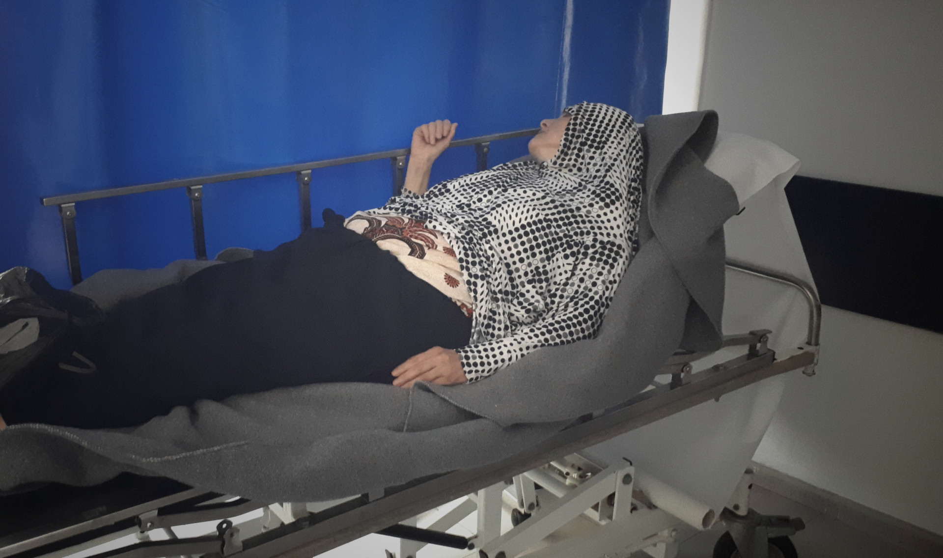 A woman had fractures in addition to pulmonary hemorrhage