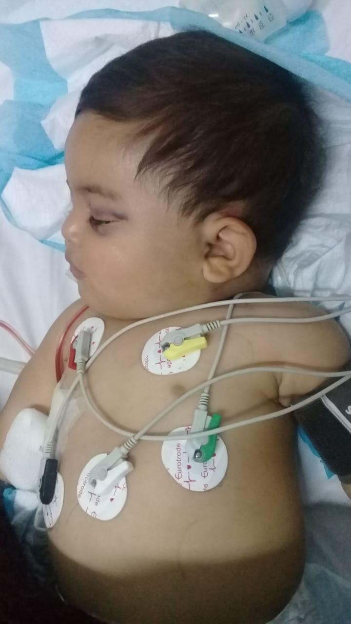 A baby had been brutaly beaten by his father!