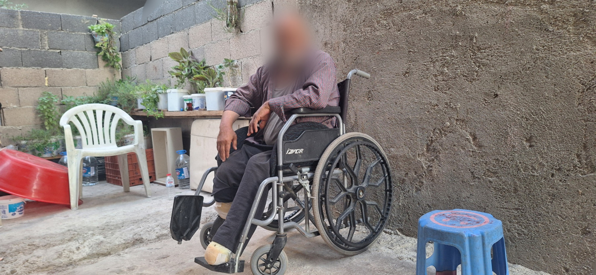 Between the pain of amputation and the burden of debt