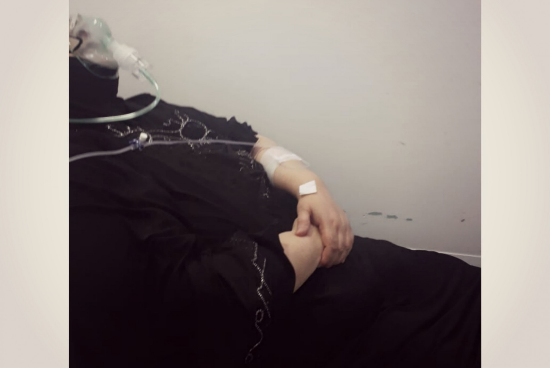 A woman suffers from hypothyroidism and anemia