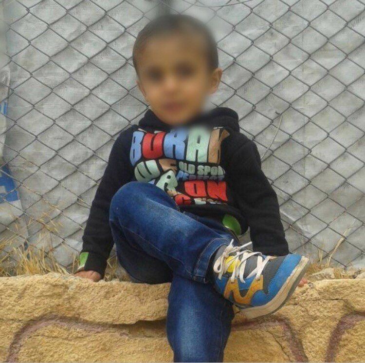 A child needs adenoidectomy ( adenoids surgery)