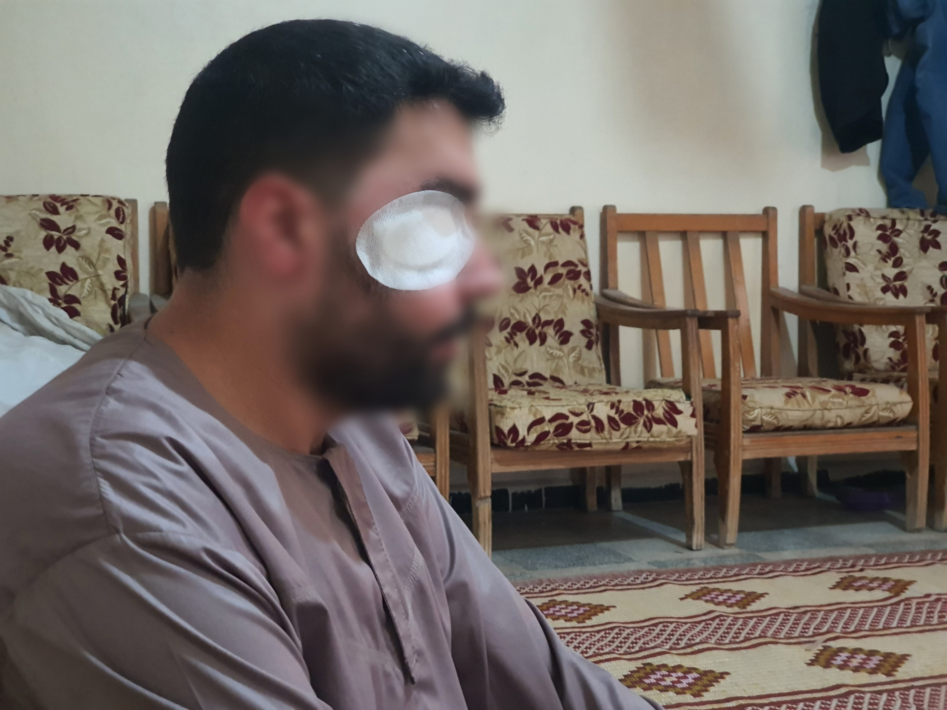 Abdul Karim was severely injured which caused him eye injury and jaw fractures!