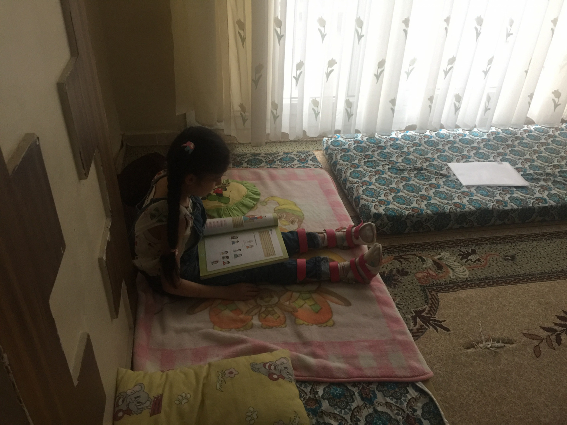 طفلة تعاني تشوهًّا خلقيًا في أرجلها