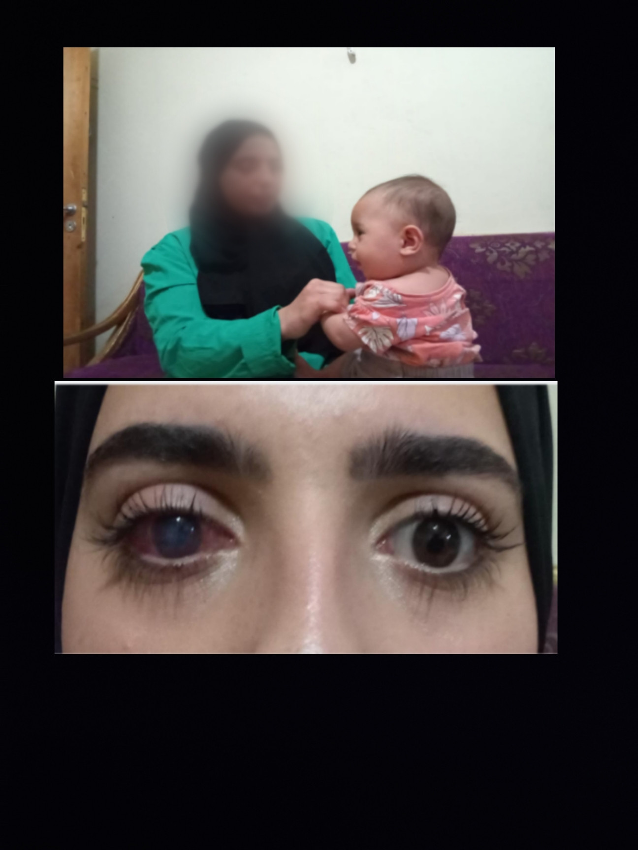 عملية زرع قرنية ستنقذ نظرها ومستقبل عائلتها