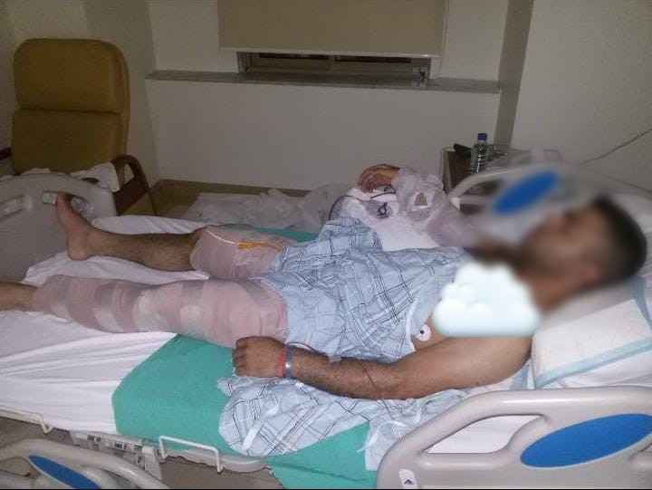 Abdul Karim can support his family due to his disability