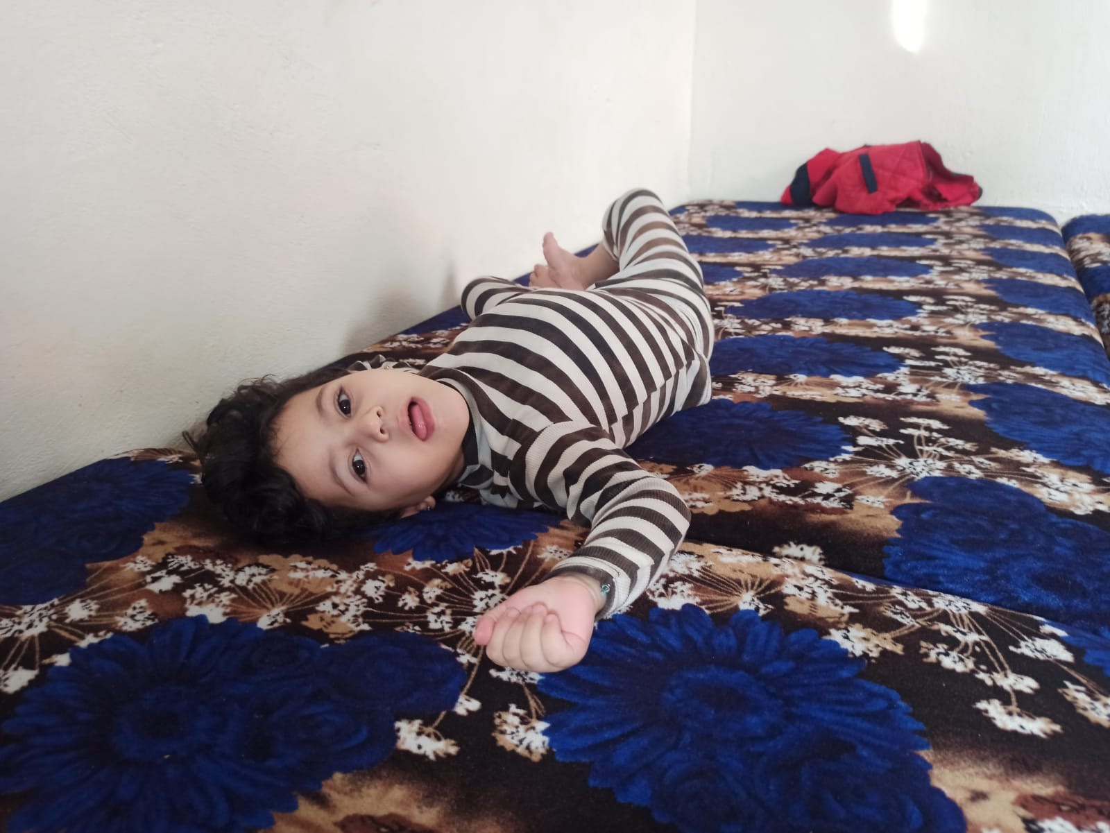 Belqis has cerebral atrophy and asthma.