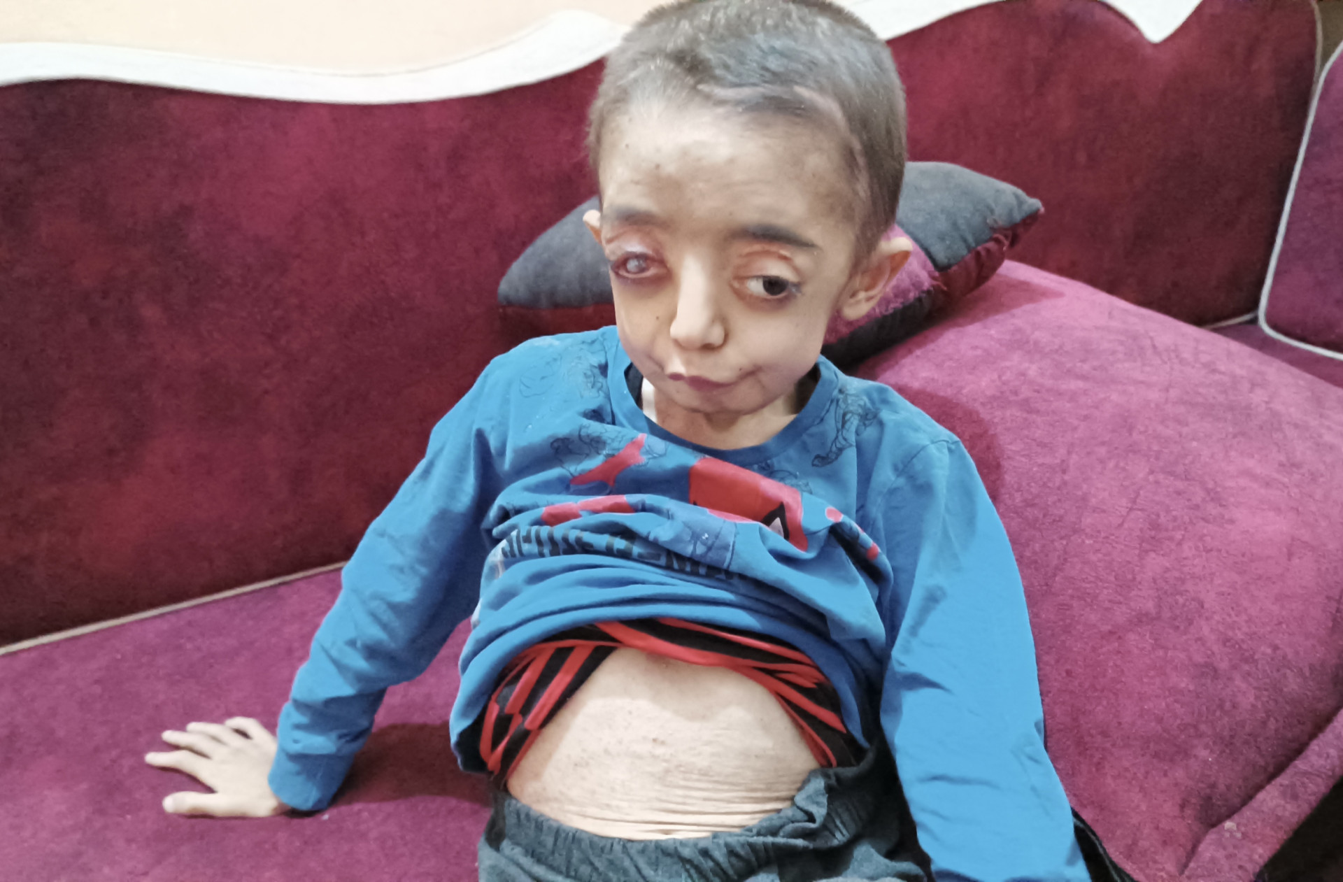 A son with cancer and a father overwhelmed