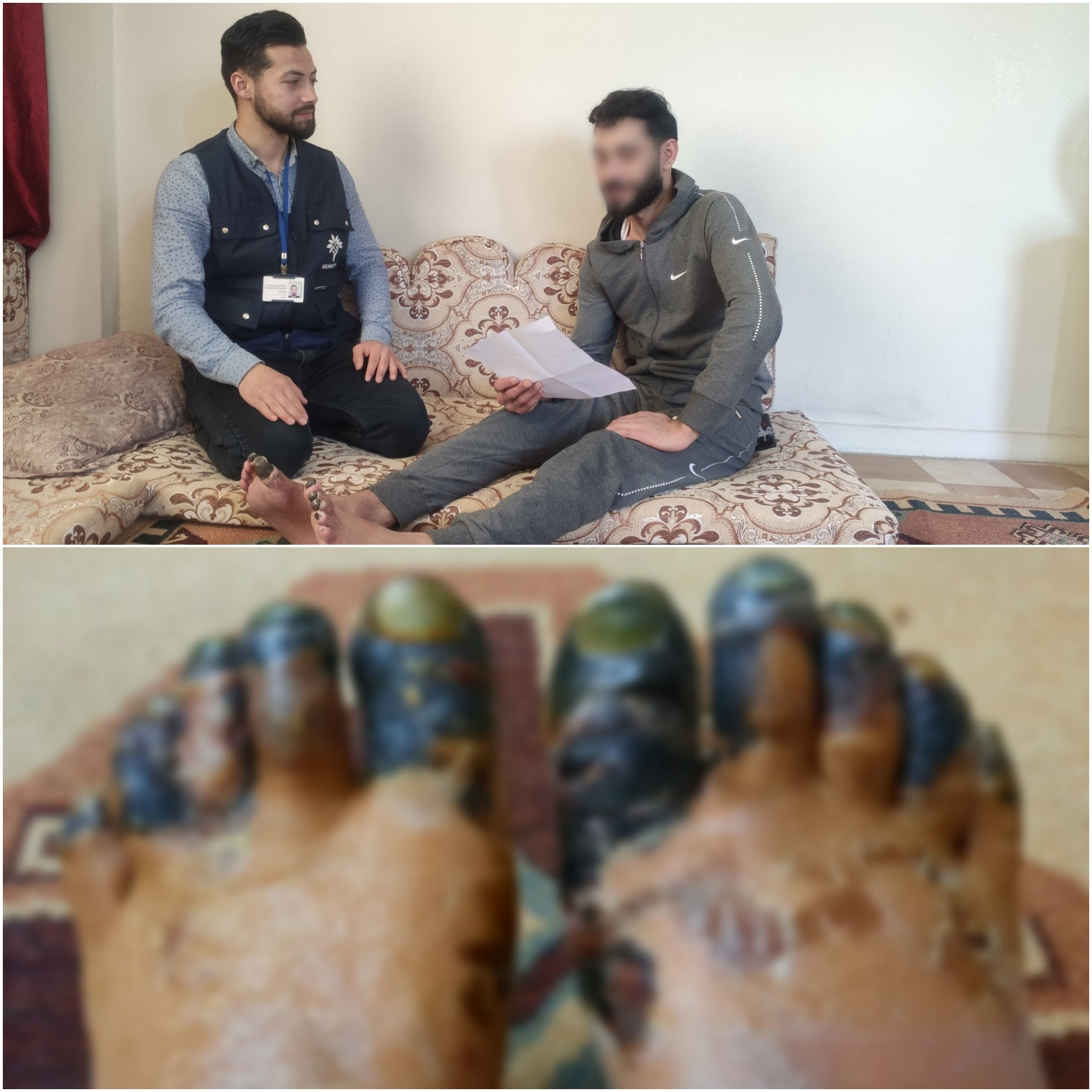 Eine Verstopfung in seinen Fußgefäßen und braucht Amputation