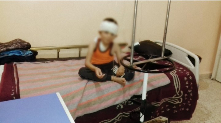 A child with hydrocephalus