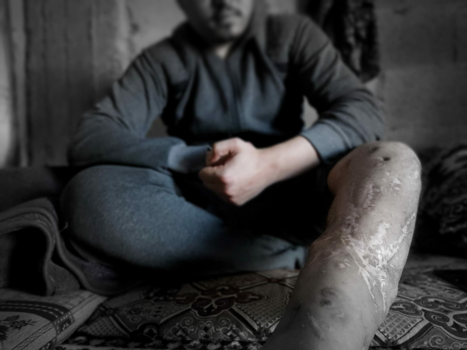 Hasan is the householder of his fmaily, needs treatment