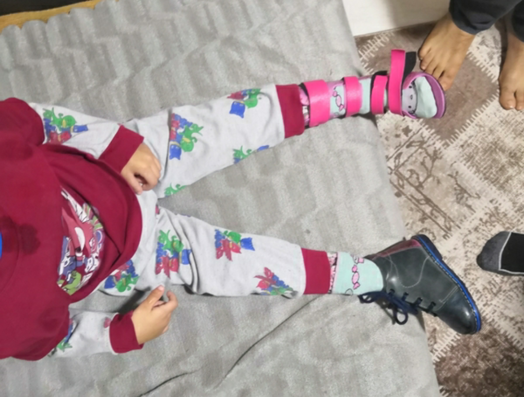 A child suffers from recurrent convulsions