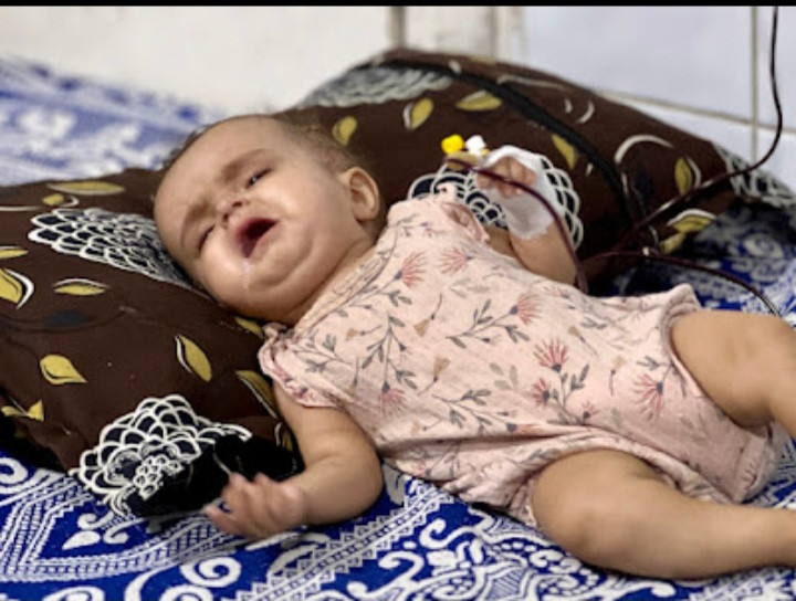 A child needs a brain shunt device!