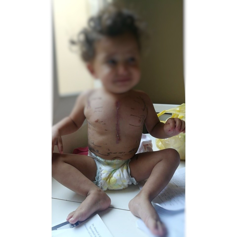 a girl with cardiac disorders