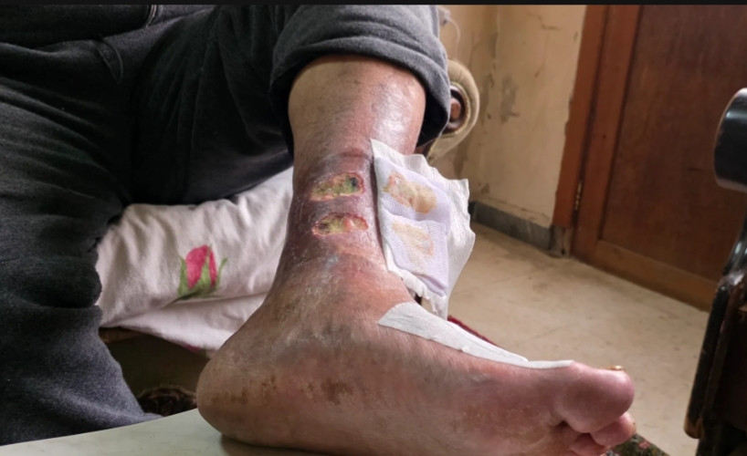 Pain that left the prison but never left the body