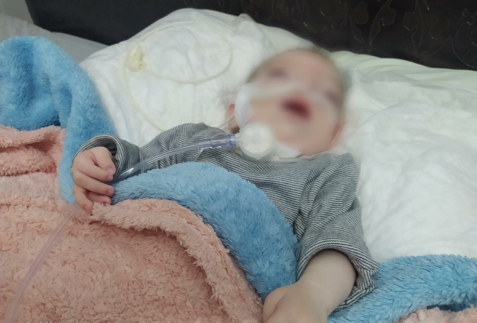 A little girl of one year needs an oxygenator