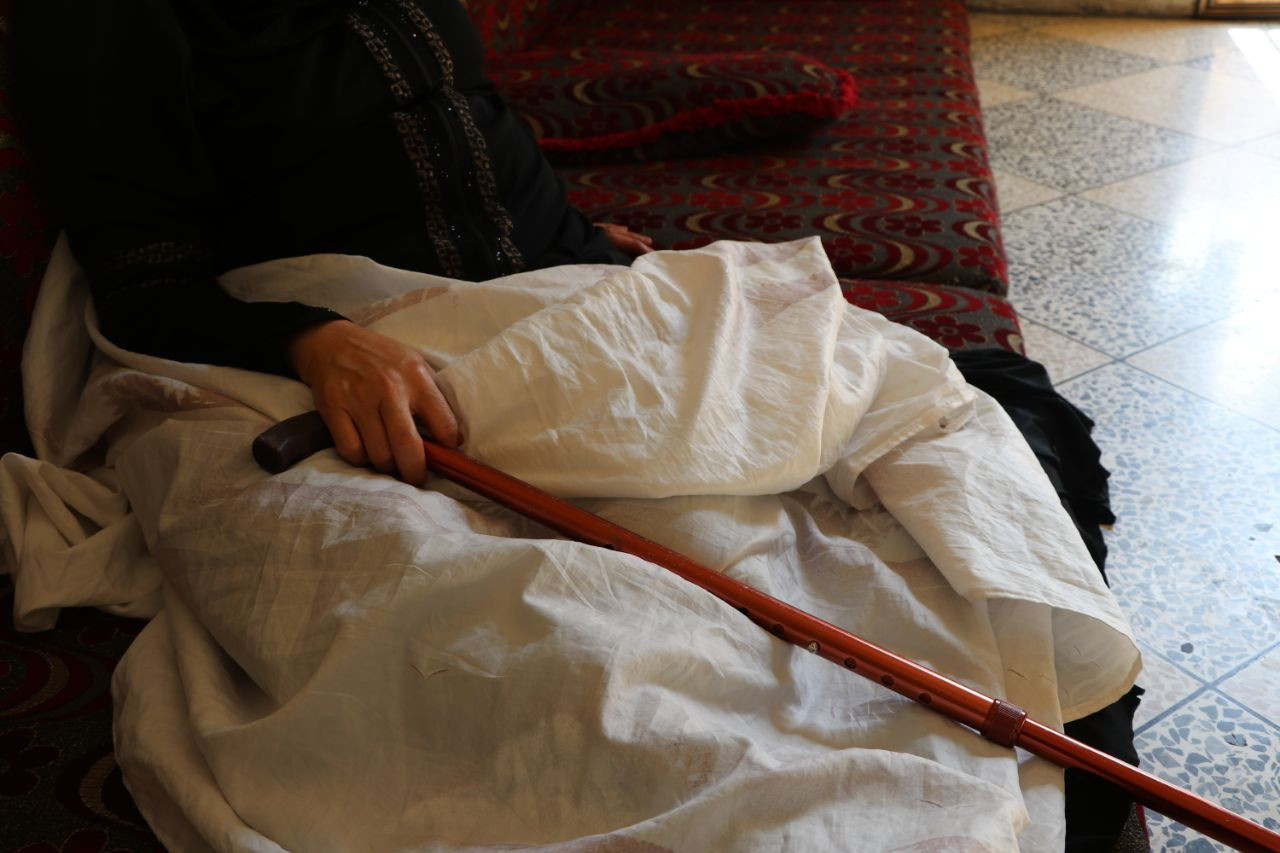 Fadeela is with Osteoarthritis and needs surgery to recover