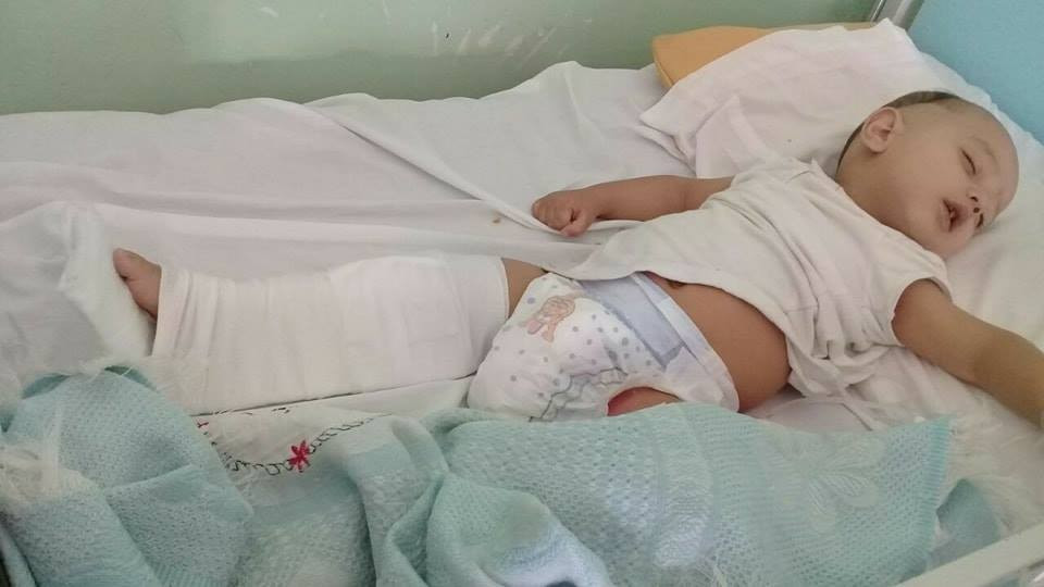 A child needs medical surgery