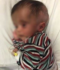 A baby, needs treatment expenses.