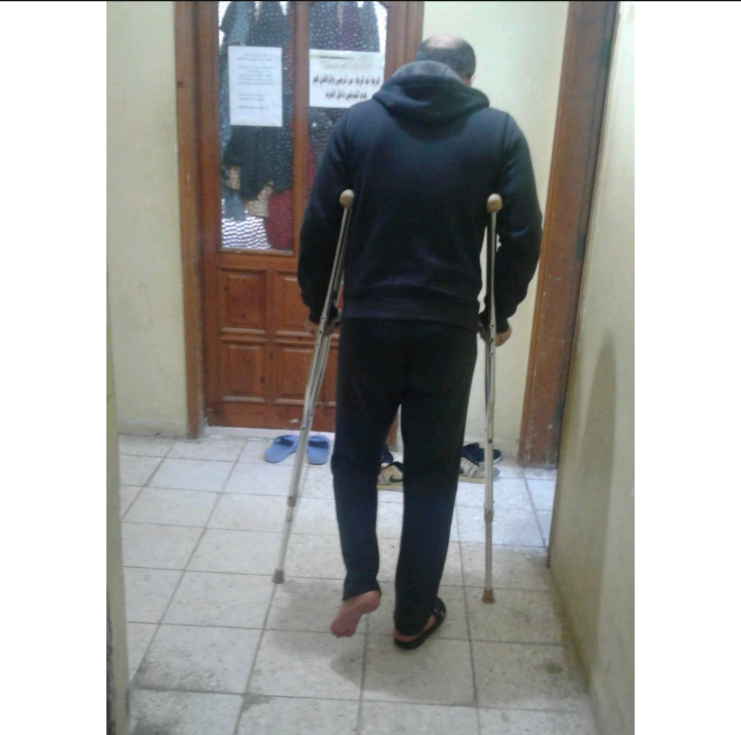 A young man was injured in his feet