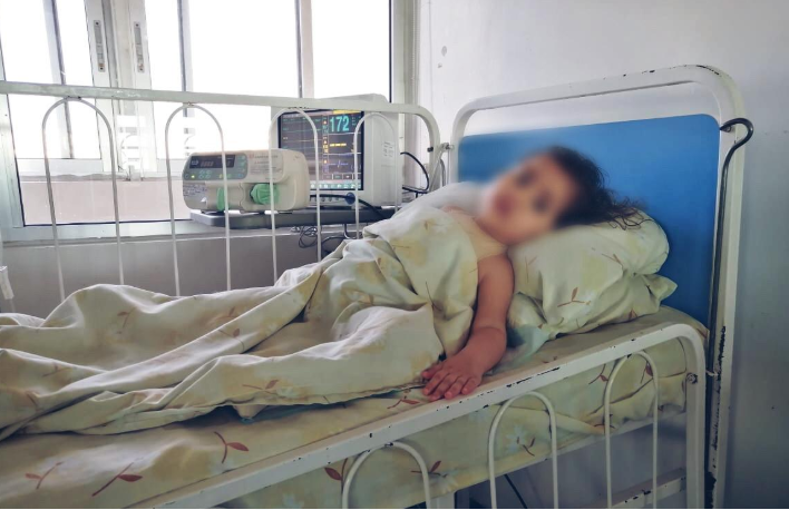 طفلة صغيرة بحاجة عمليتي زرع خلايا للجلد