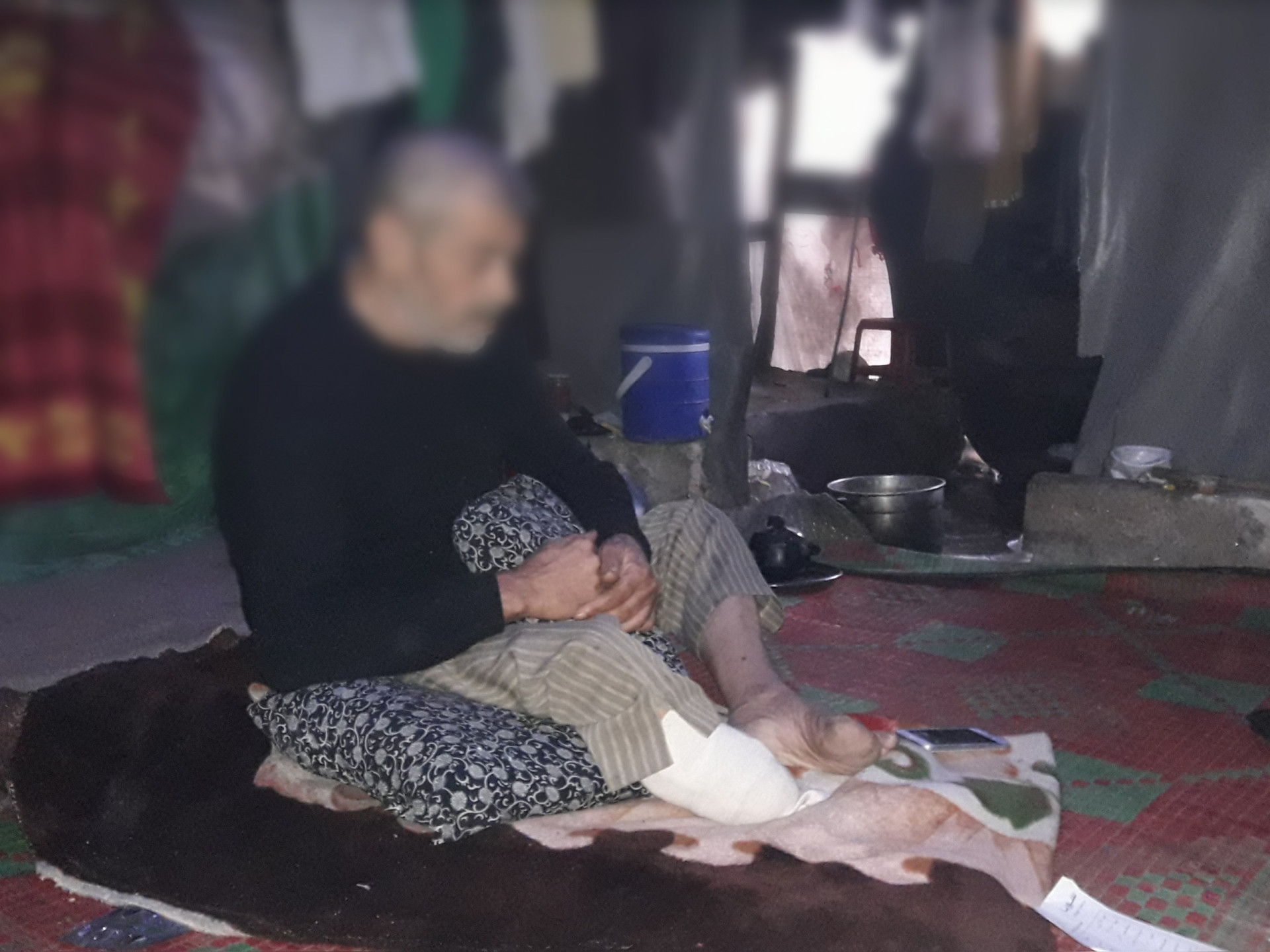 A father lost his leg