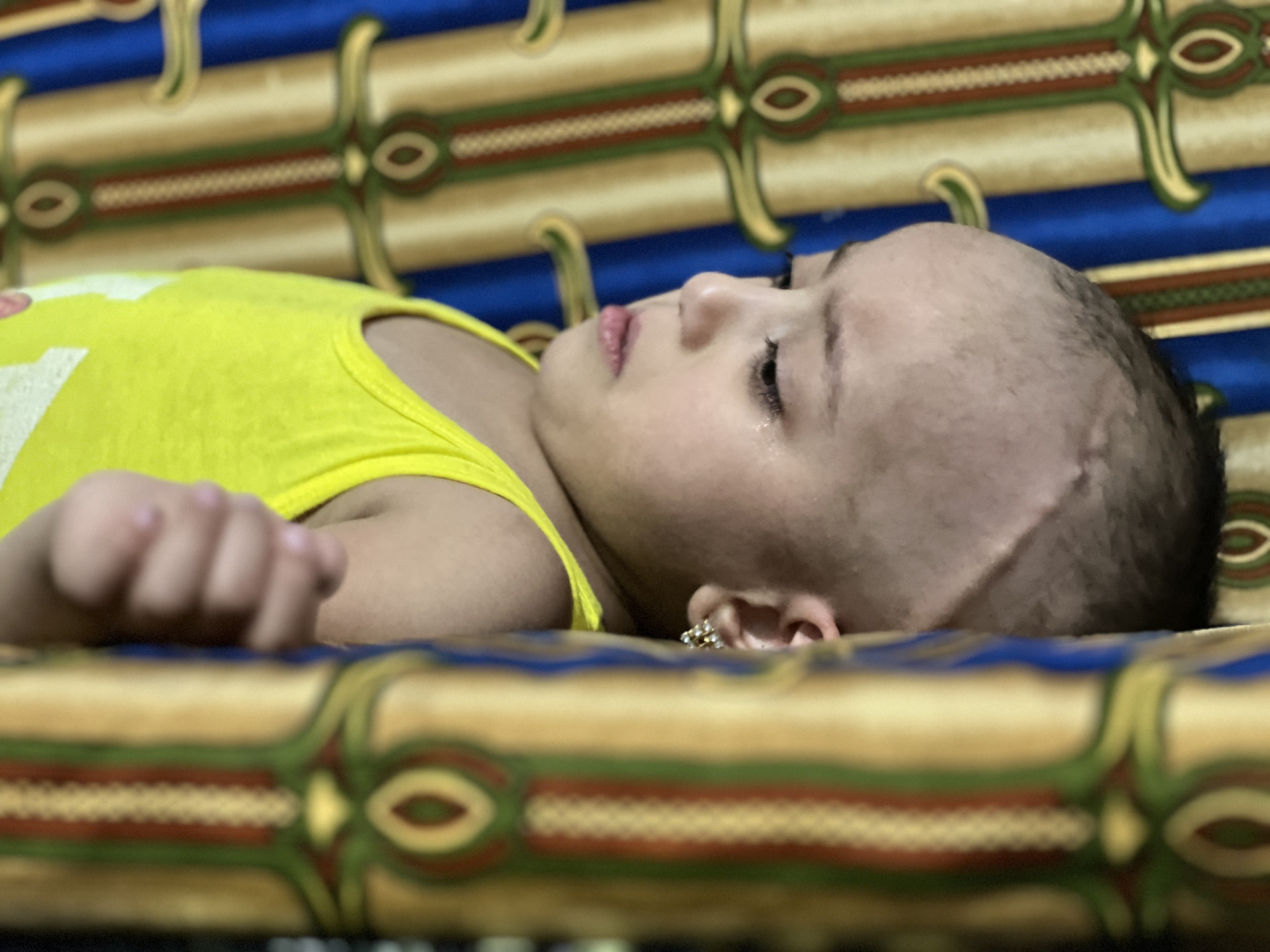 Our Little Ibtisam’s Life Is at Risk Because of Cancer