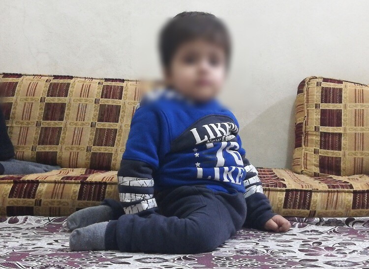 A child was born with congenital malformation!
