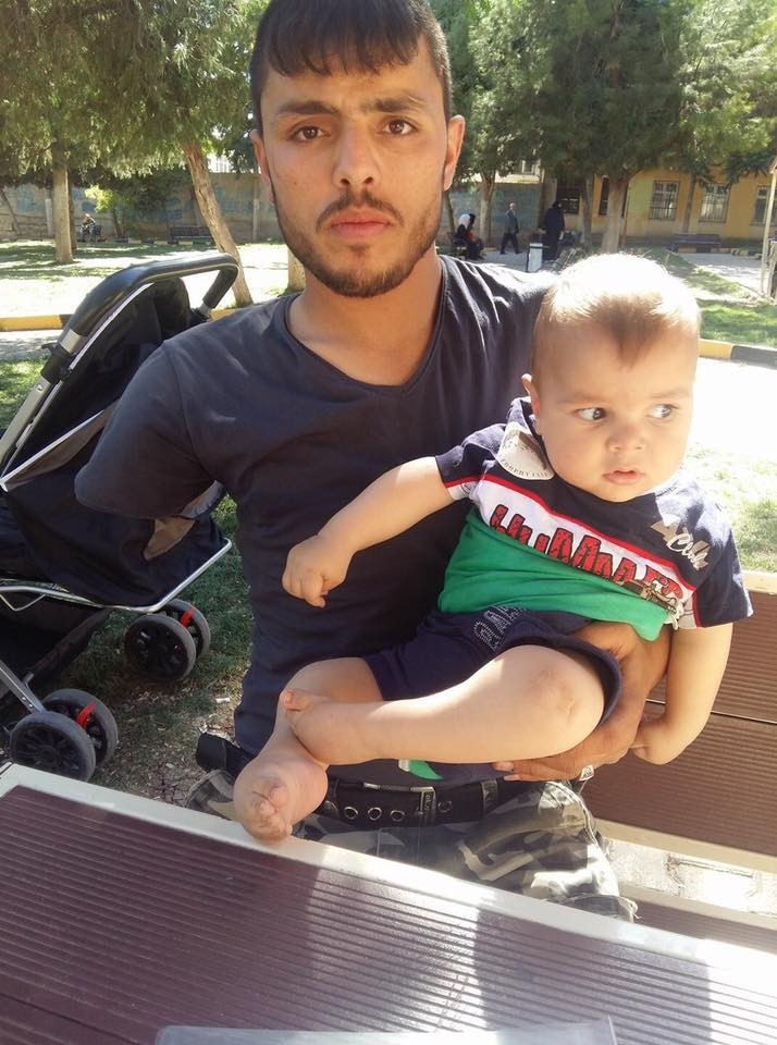 Child needing shoulder surgery