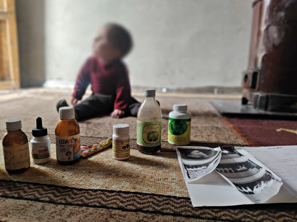 Hussam is an infant was born with cerebral atrophy and cardiac deformation