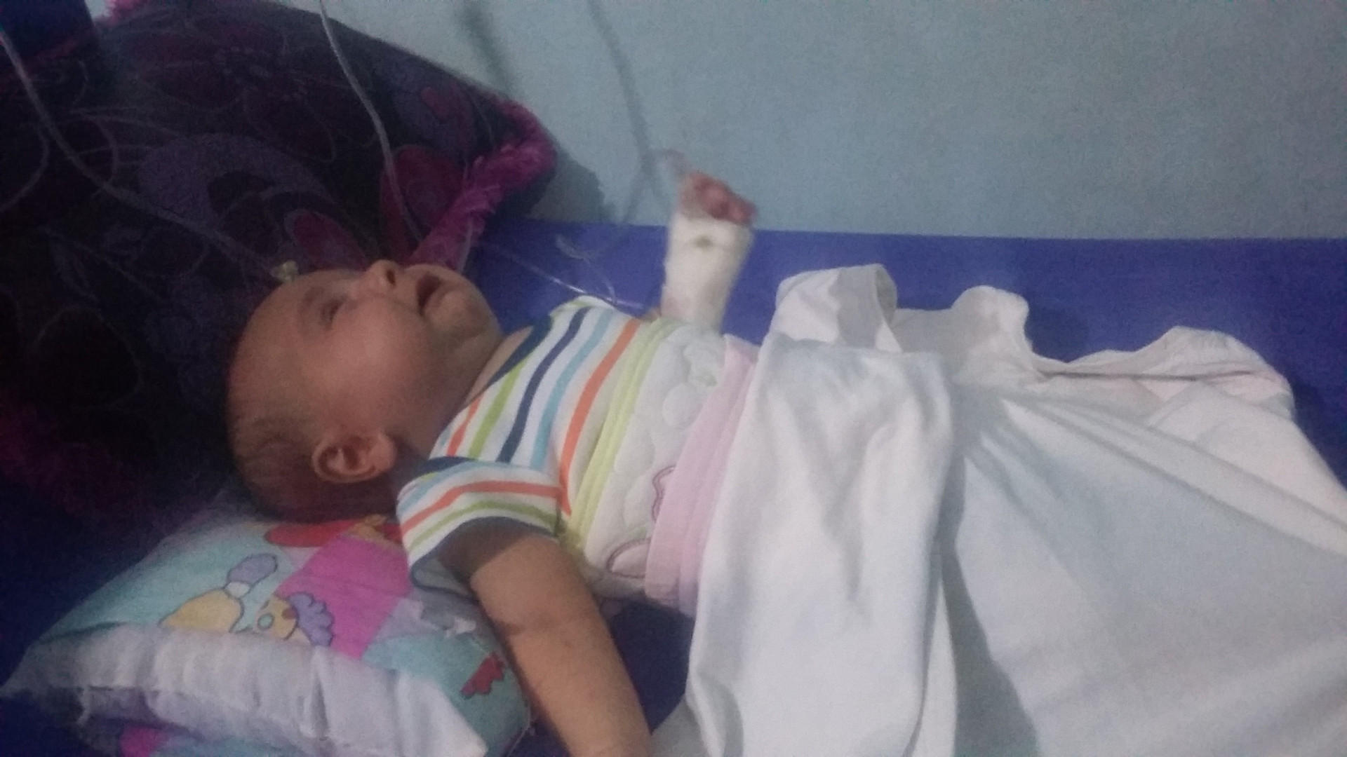 Infant needs treatment