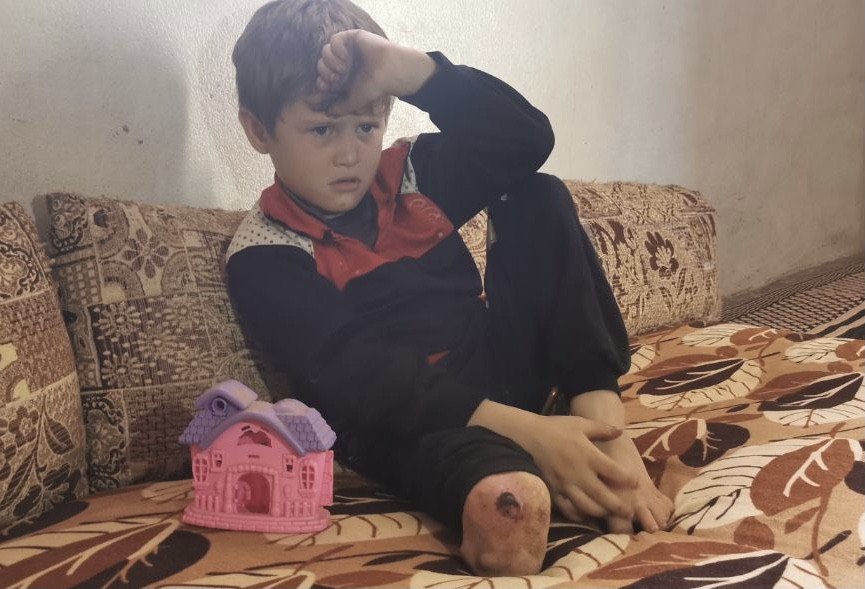 An accident deprived Ahmed of his childhood.