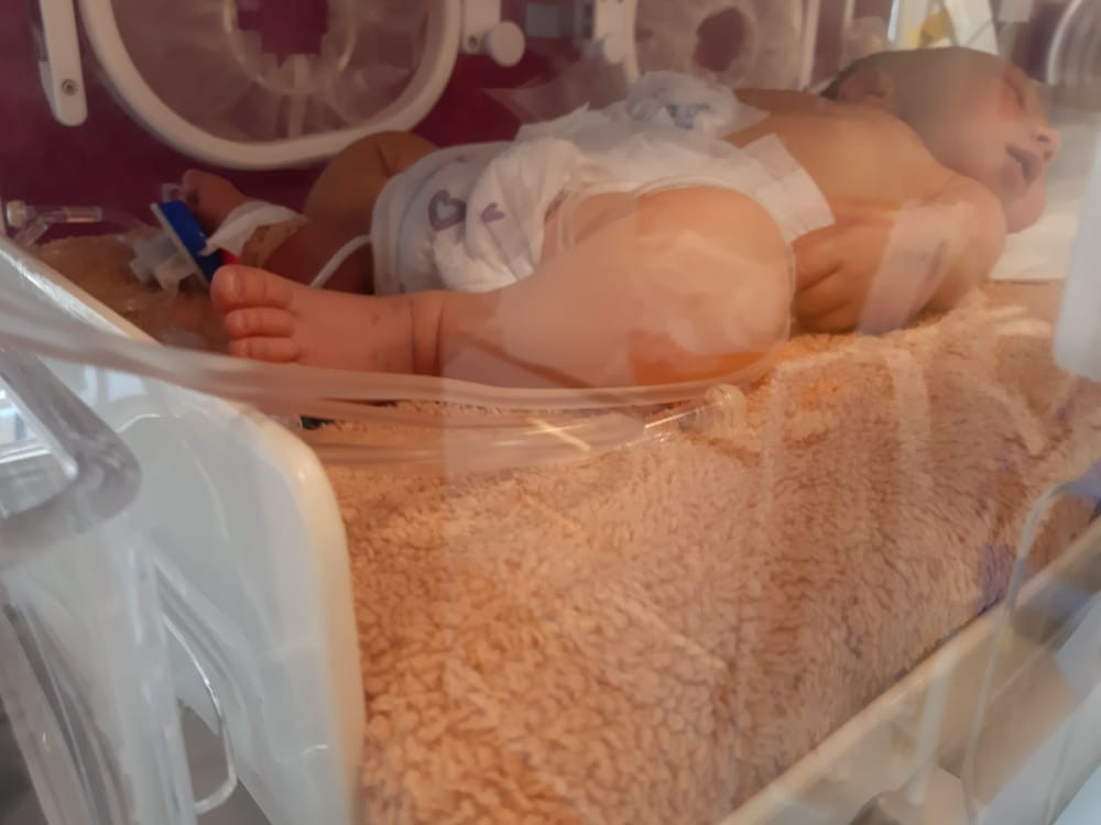 Newborn Needs Urgent Surgery